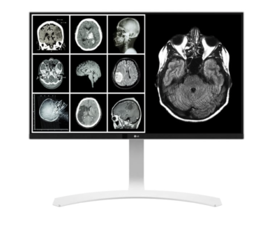 LG 27 medical monitor
