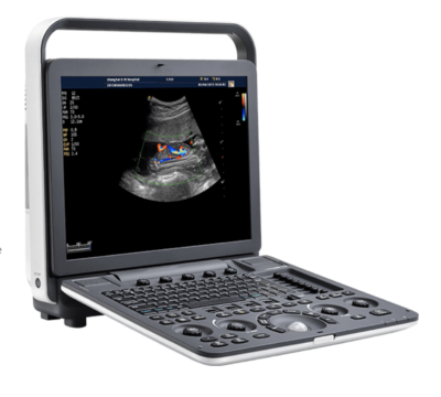 P11 Plus portable ultrasound system Color