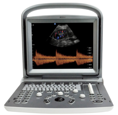 Echographe Chison ECO 6 + 2 sondes